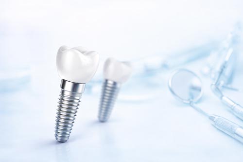 vorschau_titan-implantate